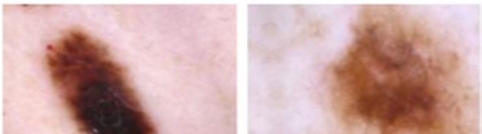 Figure from Skin Disease Prediction Software 